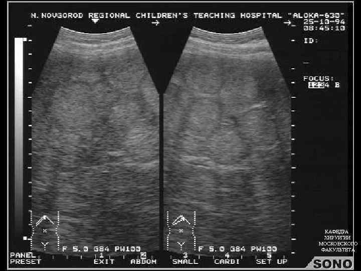 КАФЕДРА ХИРУРГИИ МОСКОВСКОГО КАФЕДРА ФАКУЛЬТЕТА ХИРУРГИИ МОСКОВСКОГО ФАКУЛЬТЕТА 
