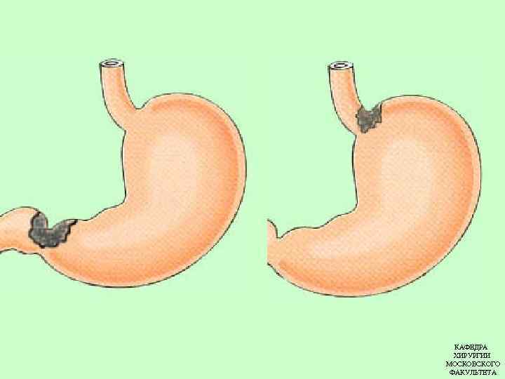 КАФЕДРА ХИРУРГИИ МОСКОВСКОГО ФАКУЛЬТЕТА 