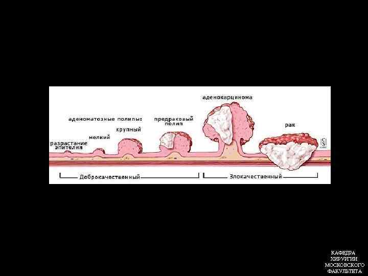 КАФЕДРА ХИРУРГИИ МОСКОВСКОГО ФАКУЛЬТЕТА 
