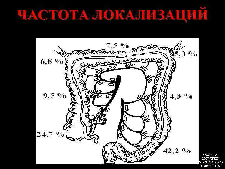 Рисунок ободочной кишки