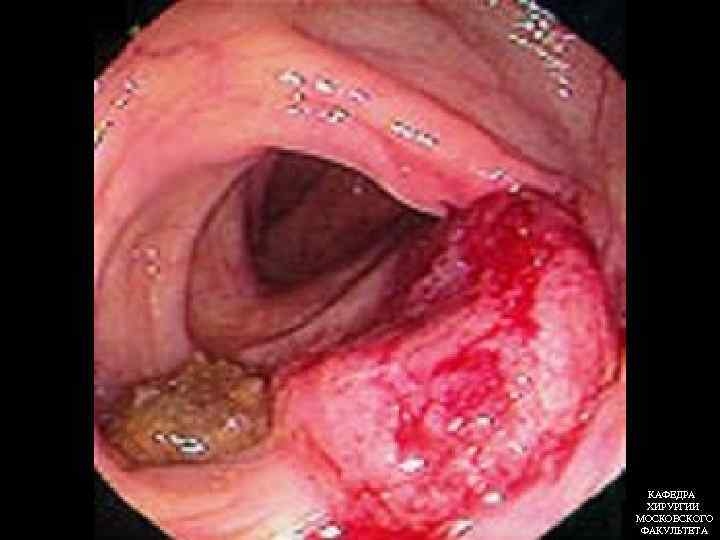КАФЕДРА ХИРУРГИИ МОСКОВСКОГО ФАКУЛЬТЕТА 