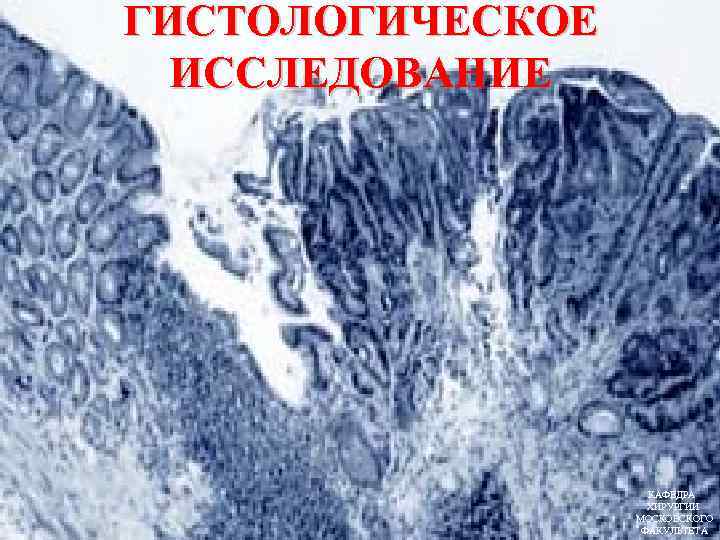 ГИСТОЛОГИЧЕСКОЕ ИССЛЕДОВАНИЕ КАФЕДРА ХИРУРГИИ МОСКОВСКОГО ФАКУЛЬТЕТА 