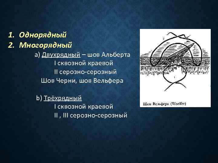 1. Однорядный 2. Многорядный a) Двухрядный – шов Альберта I сквозной краевой II серозно