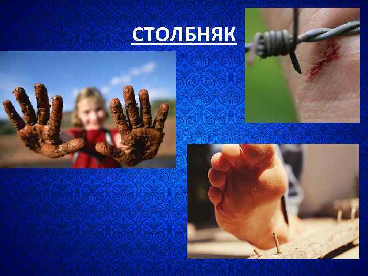 СТОЛБНЯК 