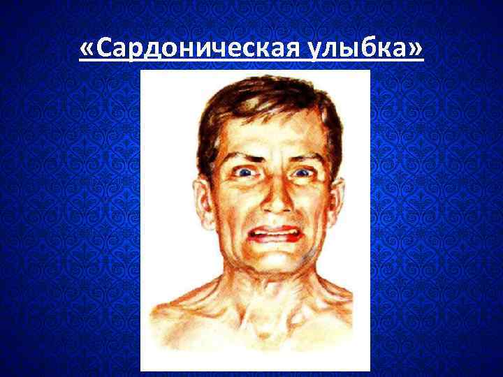  «Сардоническая улыбка» 