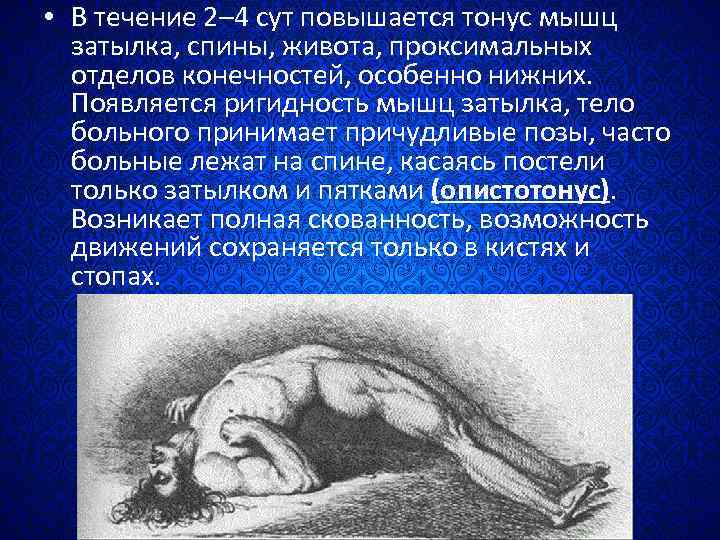  • В течение 2– 4 сут повышается тонус мышц затылка, спины, живота, проксимальных