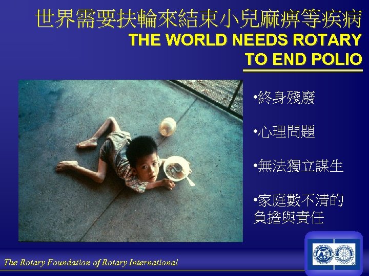 世界需要扶輪來結束小兒麻痹等疾病 THE WORLD NEEDS ROTARY TO END POLIO • 終身殘廢 • 心理問題 • 無法獨立謀生