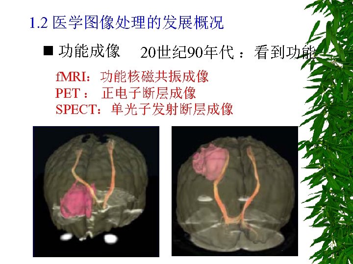 1. 2 医学图像处理的发展概况 n 功能成像 20世纪 90年代 ：看到功能 f. MRI：功能核磁共振成像 PET ： 正电子断层成像 SPECT：单光子发射断层成像
