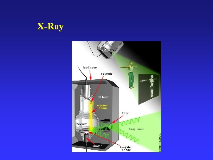 X-Ray 