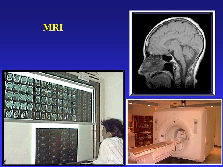 MRI 