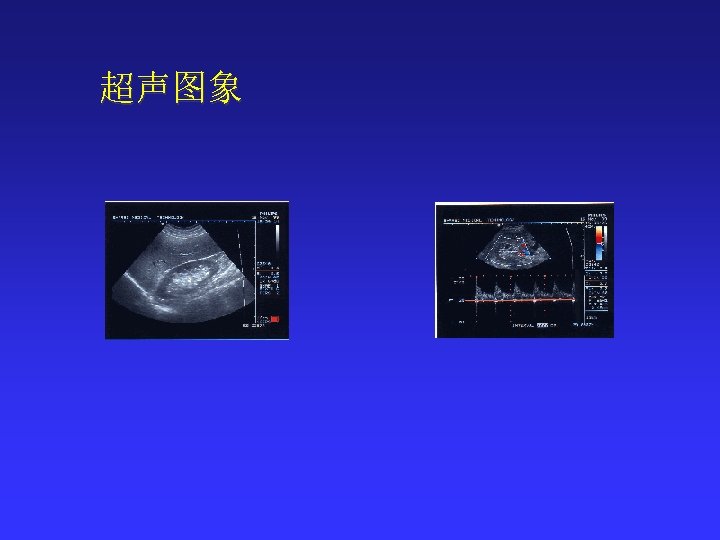 超声图象 