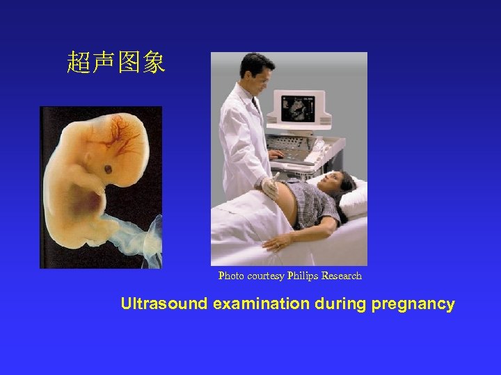 超声图象 Photo courtesy Philips Research Ultrasound examination during pregnancy 
