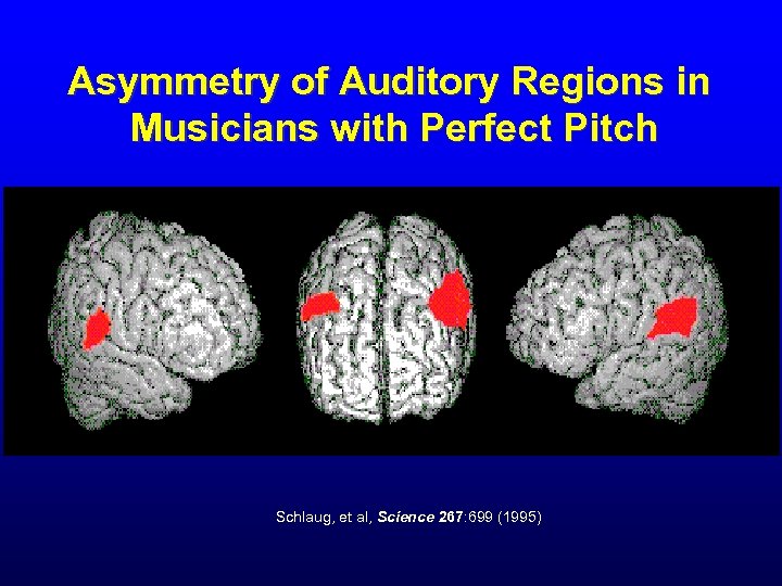 Asymmetry of Auditory Regions in Musicians with Perfect Pitch Schlaug, et al, Science 267:
