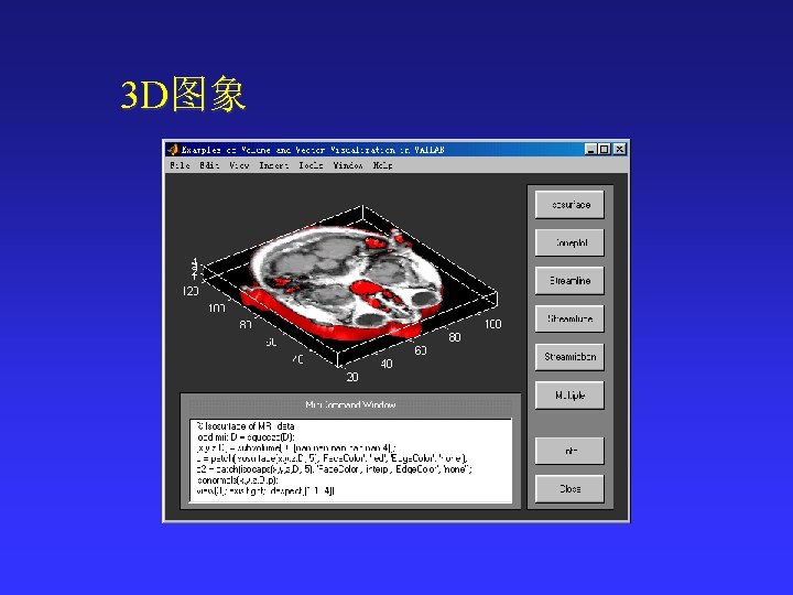 3 D图象 
