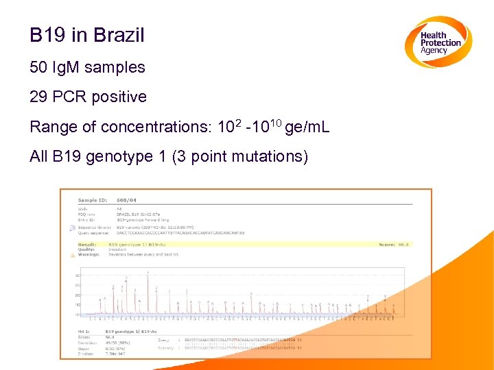 B 19 in Brazil 50 Ig. M samples 29 PCR positive Range of concentrations: