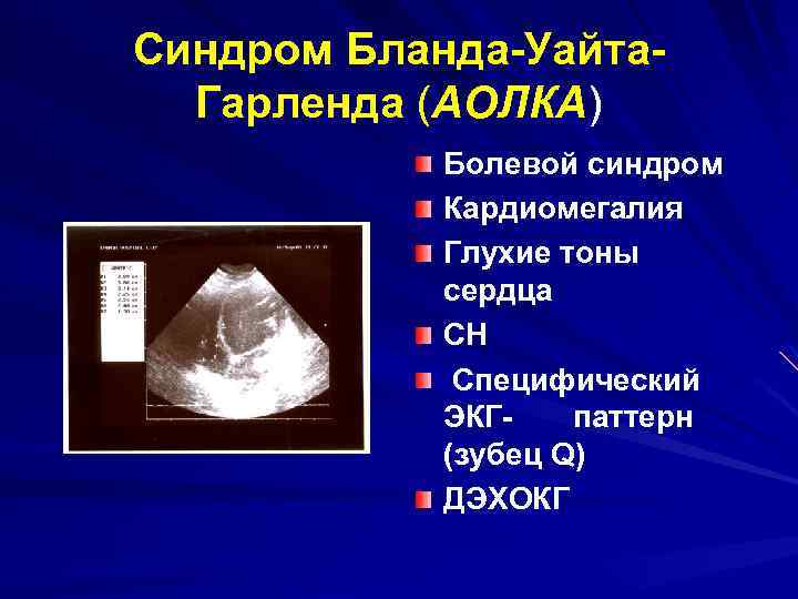 Синдром Бланда-Уайта. Гарленда (АОЛКА) Болевой синдром Кардиомегалия Глухие тоны сердца СН Специфический ЭКГпаттерн (зубец