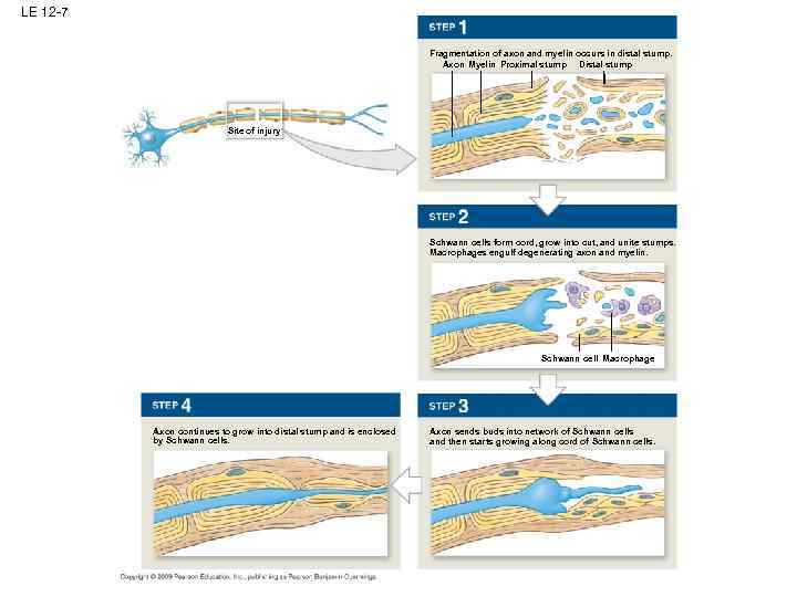 LE 12 -7 Fragmentation of axon and myelin occurs in distal stump. Axon Myelin