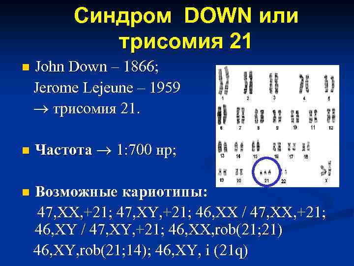 Синдром DOWN или трисомия 21 n n n John Down – 1866; Jerome Lejeune