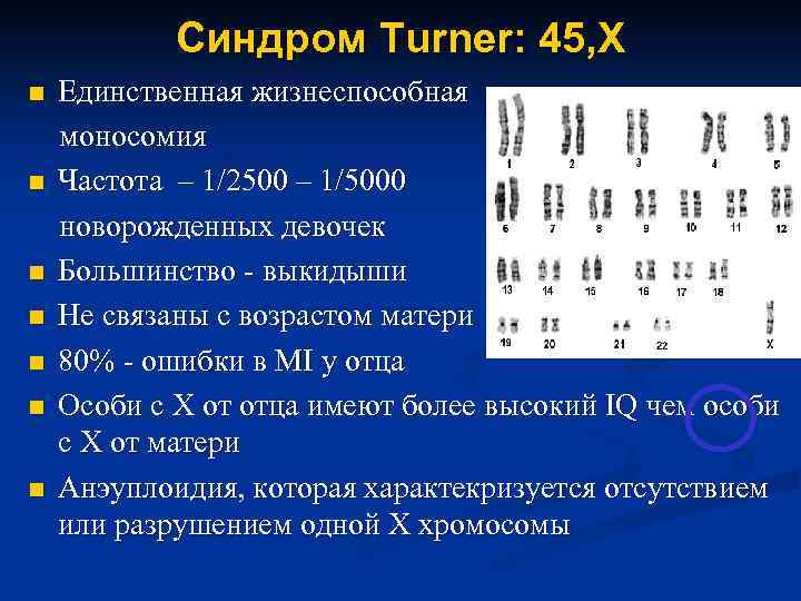 Синдром Turner: 45, X n n n n Единственная жизнеспособная моносомия Частота – 1/2500