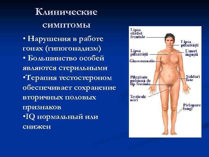 Клинические симптомы • Нарушения в работе гонах (гипогонадизм) • Большинство особей являются стерильными •