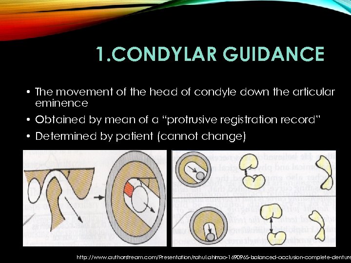 1. CONDYLAR GUIDANCE • The movement of the head of condyle down the articular