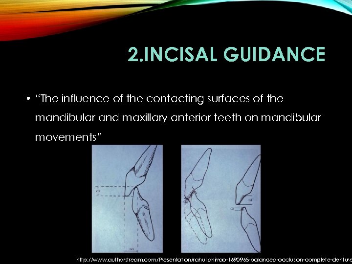 2. INCISAL GUIDANCE • “The influence of the contacting surfaces of the mandibular and