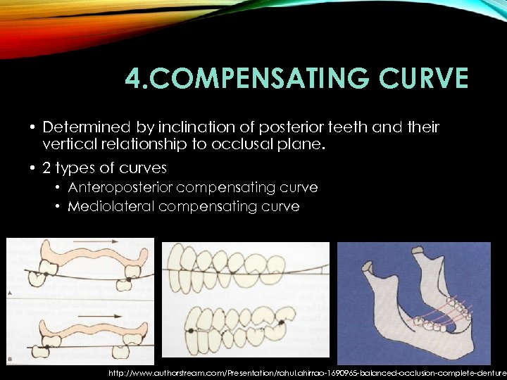 4. COMPENSATING CURVE • Determined by inclination of posterior teeth and their vertical relationship