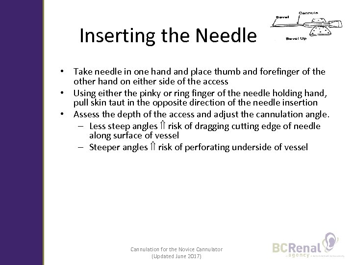 Inserting the Needle • Take needle in one hand place thumb and forefinger of