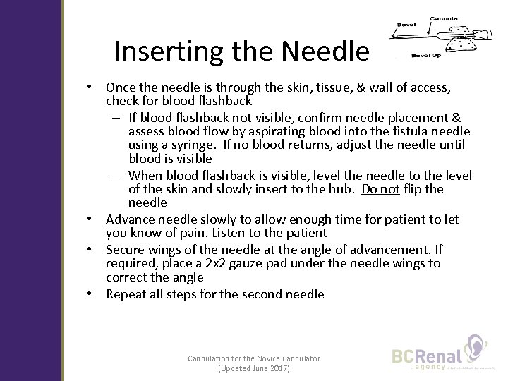 Inserting the Needle • Once the needle is through the skin, tissue, & wall