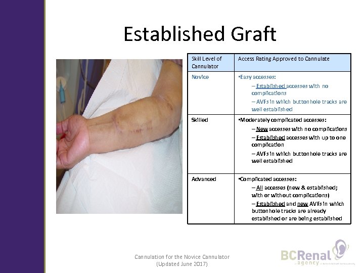 Established Graft Skill Level of Cannulator Access Rating Approved to Cannulate Novice • Easy