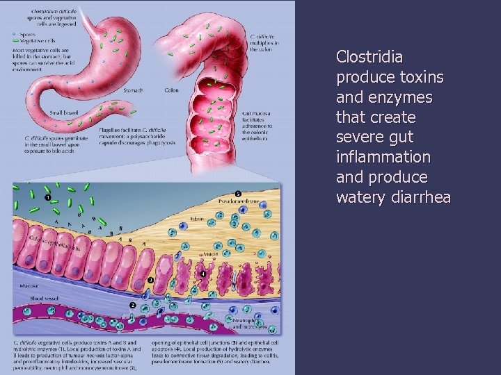 Clostridia produce toxins and enzymes that create severe gut inflammation and produce watery diarrhea