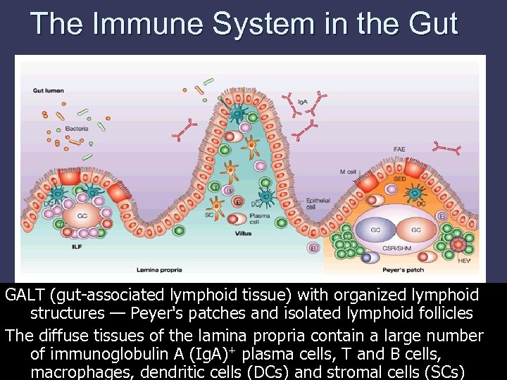 The Immune System in the Gut GALT (gut-associated lymphoid tissue) with organized lymphoid structures