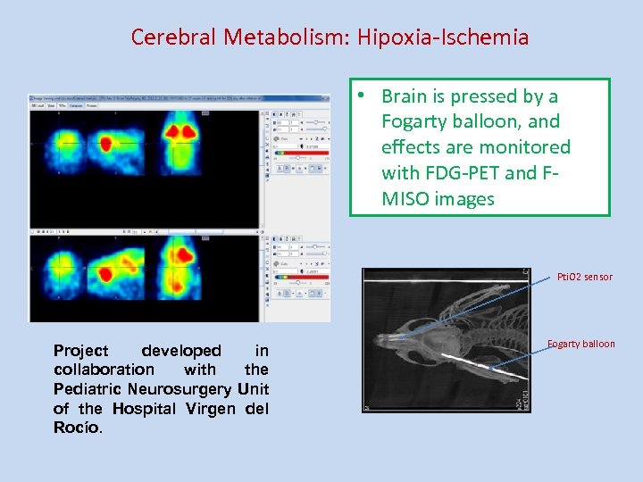 Cerebral Metabolism: Hipoxia-Ischemia • Brain is pressed by a Fogarty balloon, and effects are