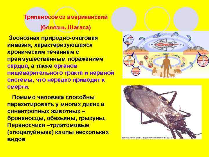 Трипаносомоз американский (болезнь Шагаса) Зоонозная природно-очаговая инвазия, характеризующаяся хроническим течением с преимущественным поражением сердца,