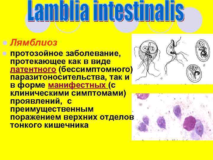 l Лямблиоз l протозойное заболевание, протекающее как в виде латентного (бессимптомного) паразитоносительства, так и