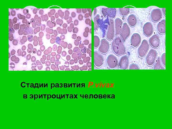 Стадии развития P. vivax в эритроцитах человека 
