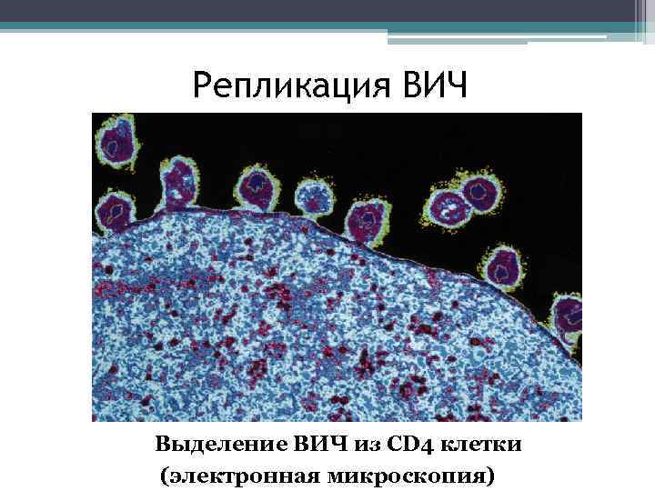 Репликация ВИЧ Выделение ВИЧ из CD 4 клетки (электронная микроскопия) 
