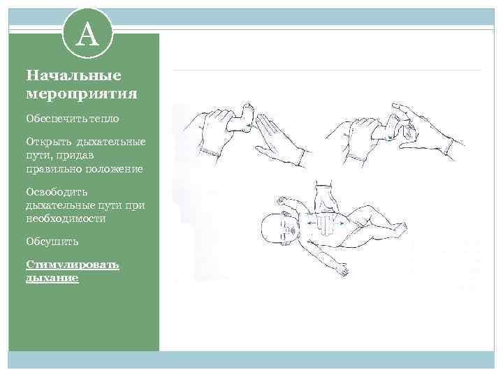 A Начальные мероприятия Обеспечить тепло Открыть дыхательные пути, придав правильно положение Освободить дыхательные пути