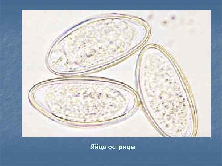 Яйцо острицы 