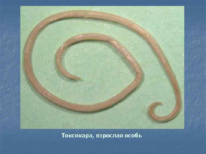 Токсокара, взрослая особь 
