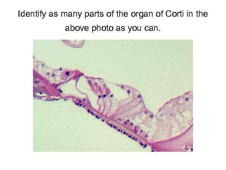 Identify as many parts of the organ of Corti in the above photo as