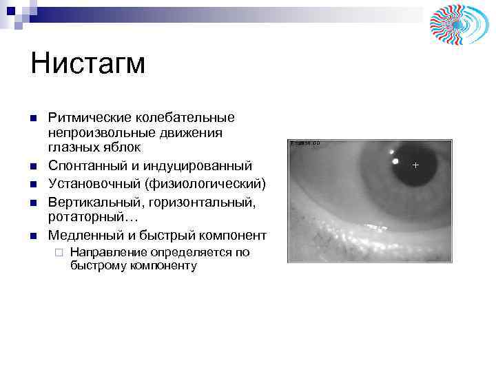 Нистагм n n n Ритмические колебательные непроизвольные движения глазных яблок Спонтанный и индуцированный Установочный