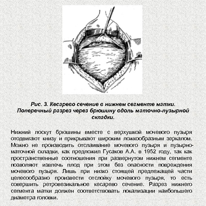 Плодоразрушающие операции презентация