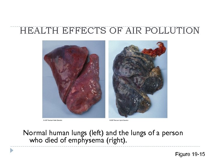HEALTH EFFECTS OF AIR POLLUTION Normal human lungs (left) and the lungs of a