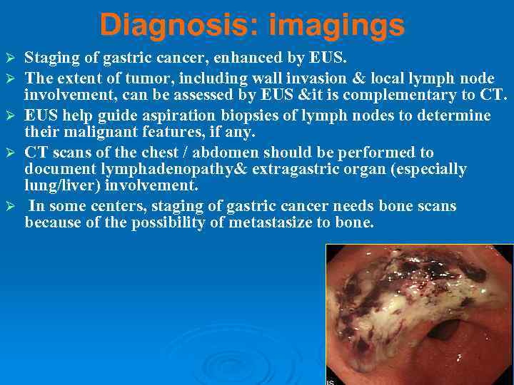 Diagnosis: imagings Ø Ø Ø Staging of gastric cancer, enhanced by EUS. The extent