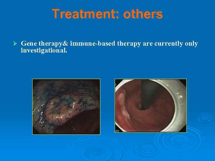 Treatment: others Ø Gene therapy& immune-based therapy are currently only investigational. 