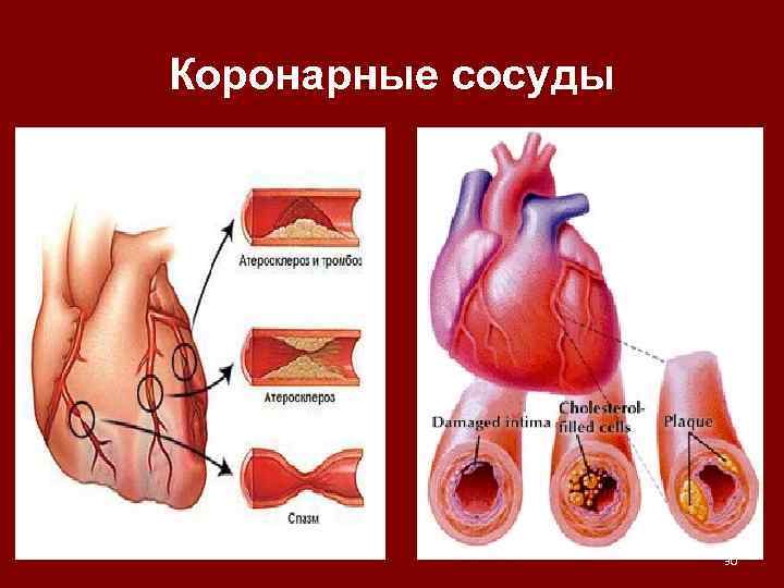 Коронарные сосуды 30 