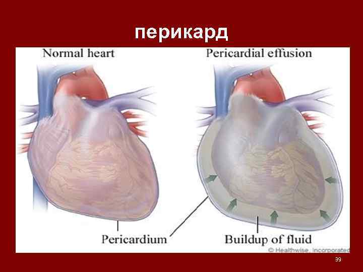 перикард 39 