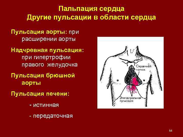 Пальпация сердца Другие пульсации в области сердца Пульсация аорты: при расширении аорты Надчревная пульсация: