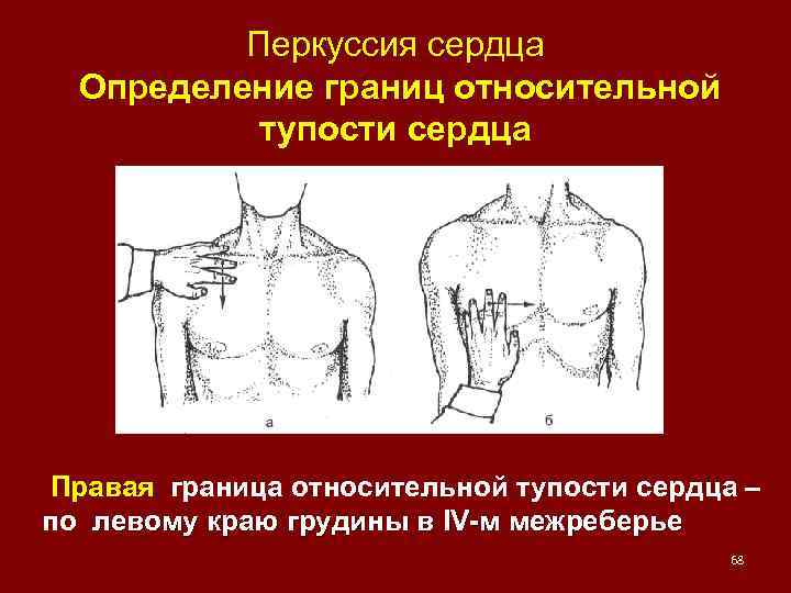 Перкуссия сердца Определение границ относительной тупости сердца Правая граница относительной тупости сердца – по